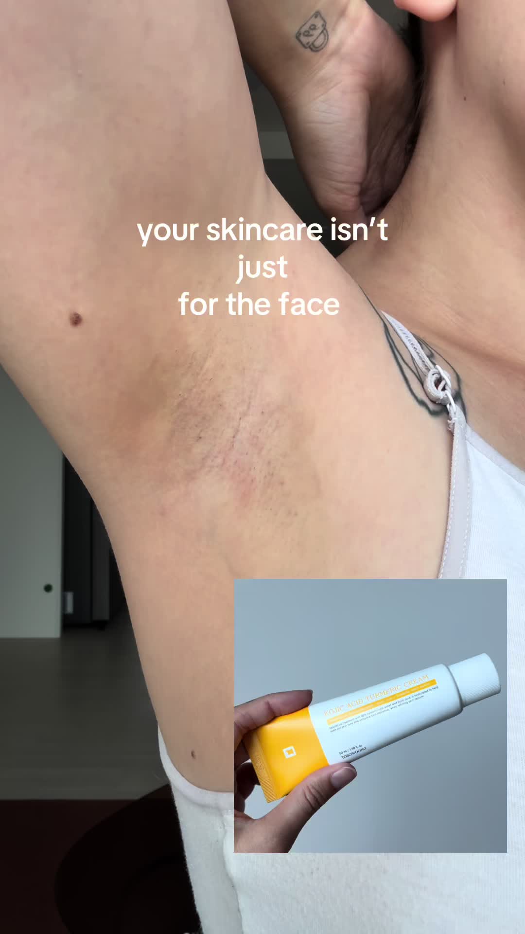 @Fanny