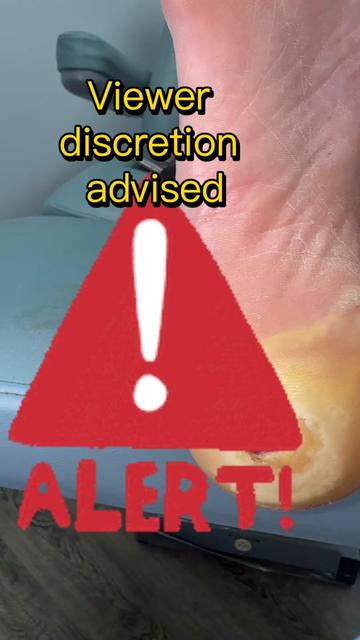 @Deniel Foot and Ankle Center