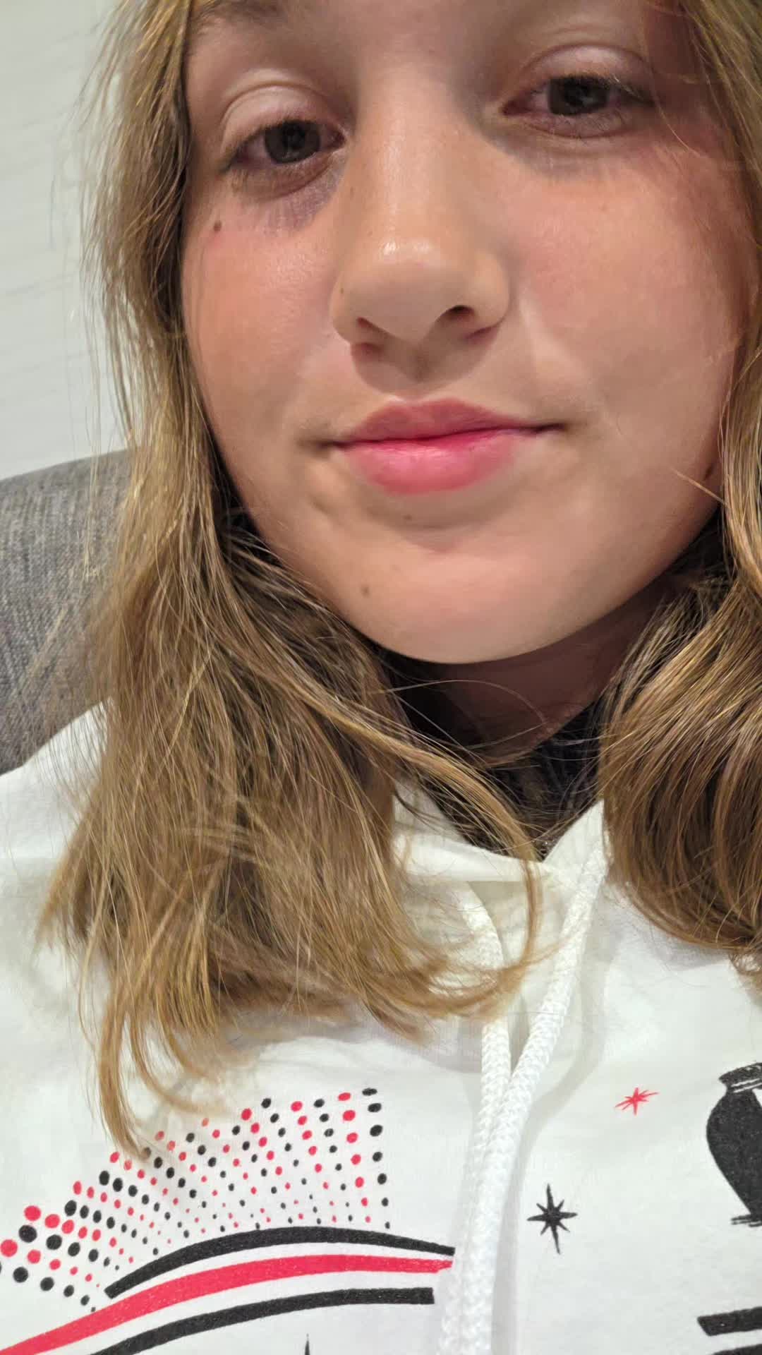 @Alison