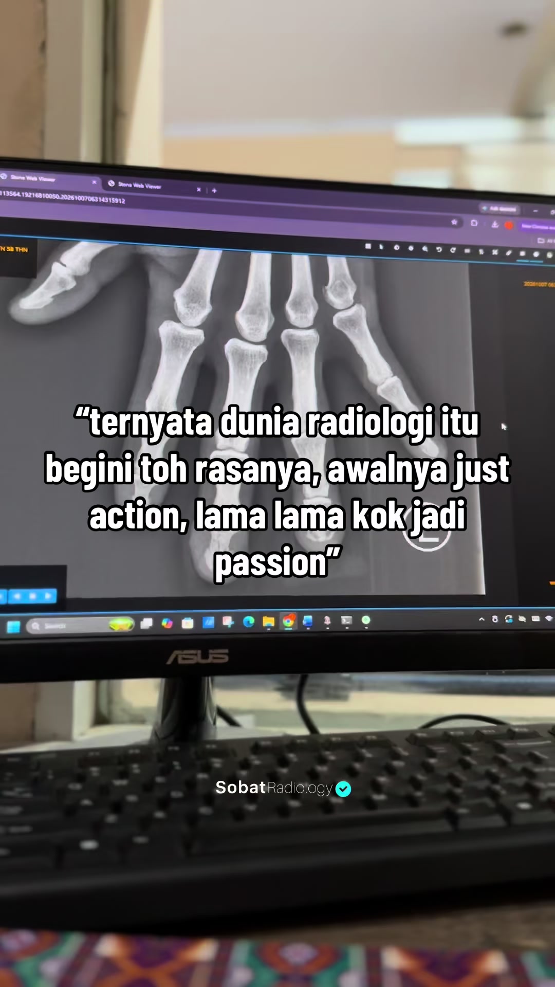 @Sobat Radiology