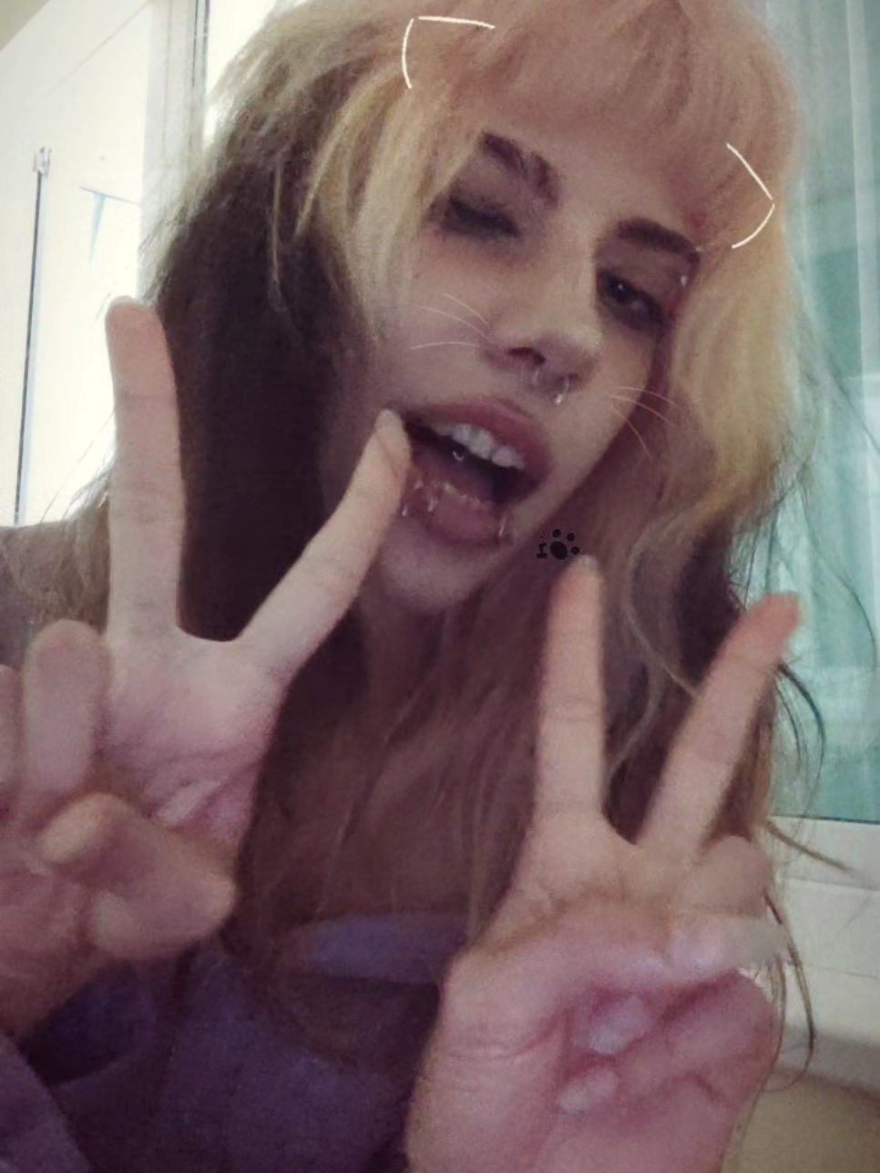 @URINYY