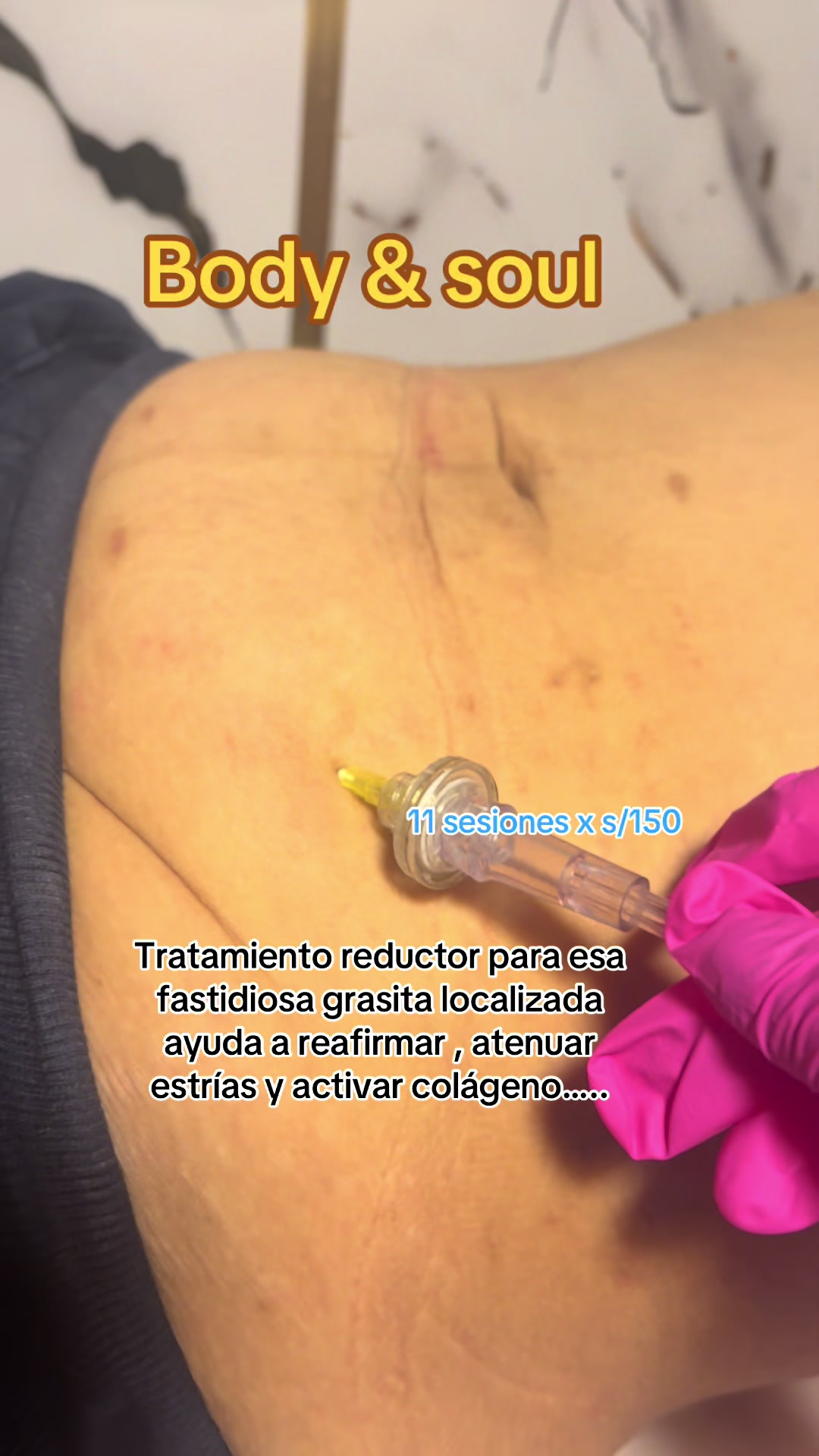 @rosariocastimedi