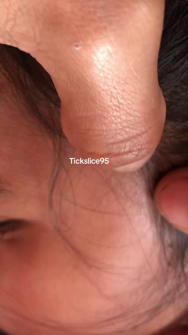 @Tickslice95