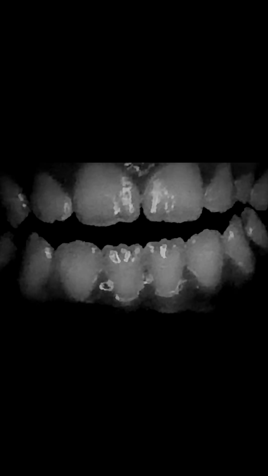 @Mouth singing
