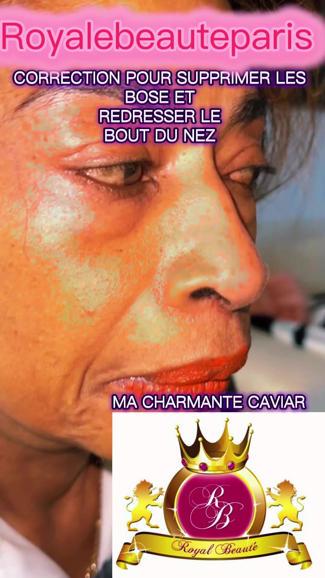 @royalebeauteparis