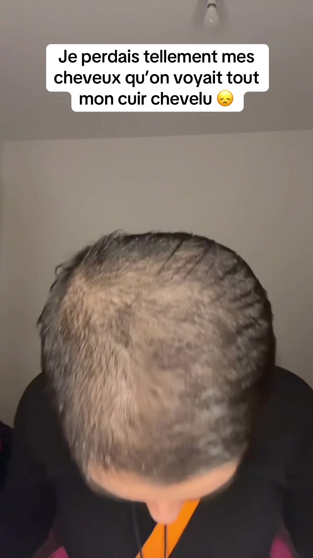 @Lux’Hair Growth