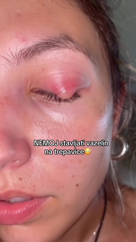 @VELLA