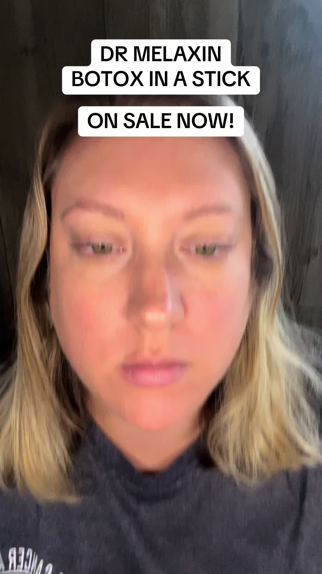@ALEXIS ✨