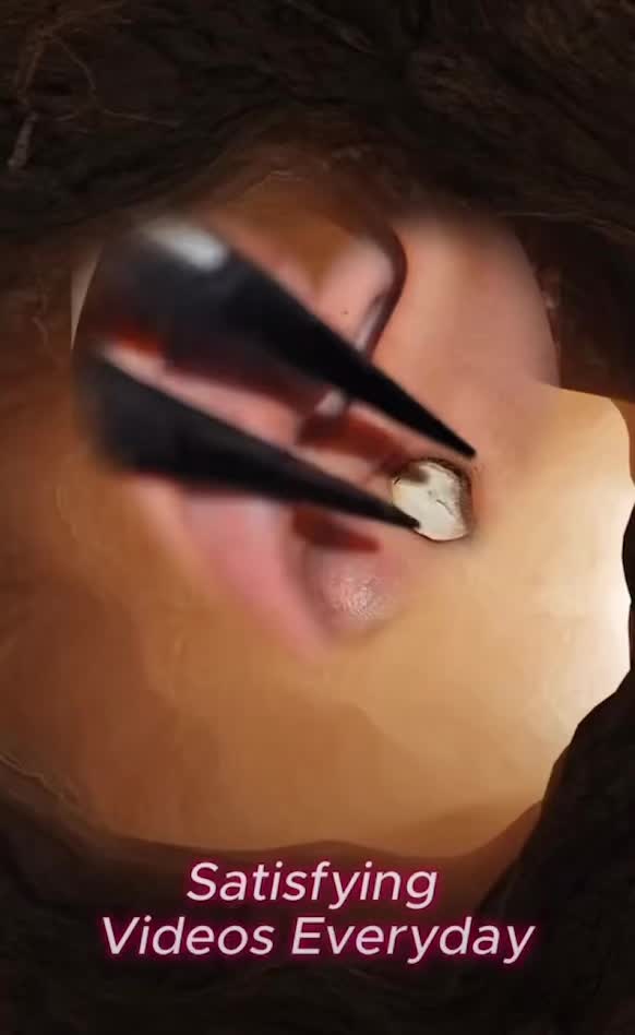 @.