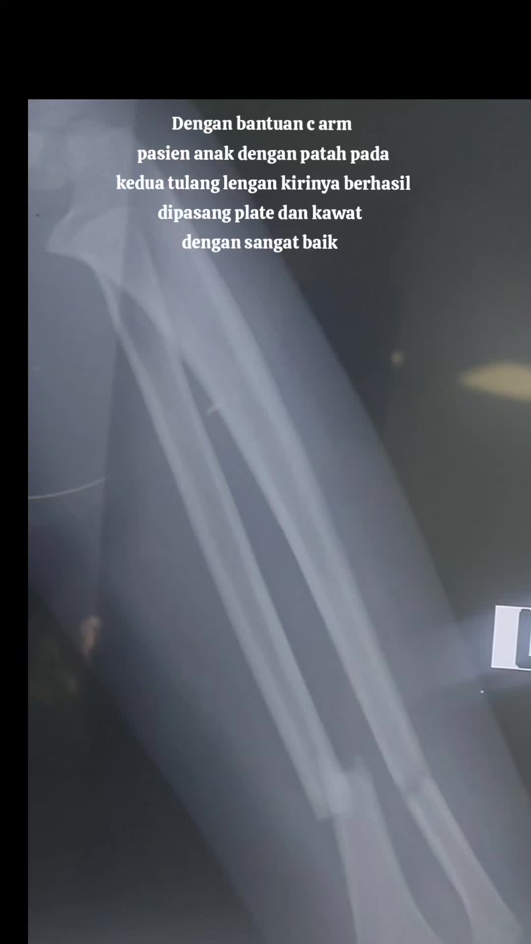 @KAMAR OPERASI