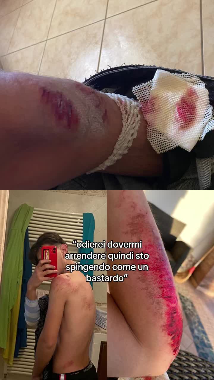 @ale