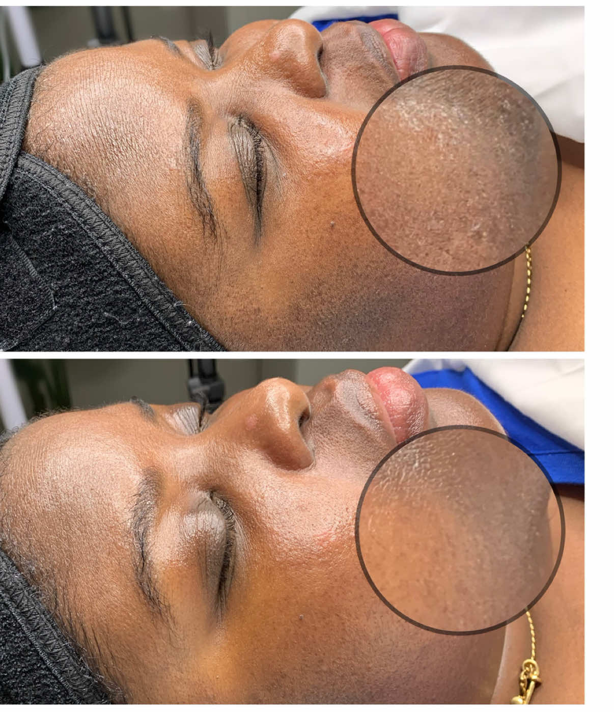 @Zee | Frisco Texas Esthetician