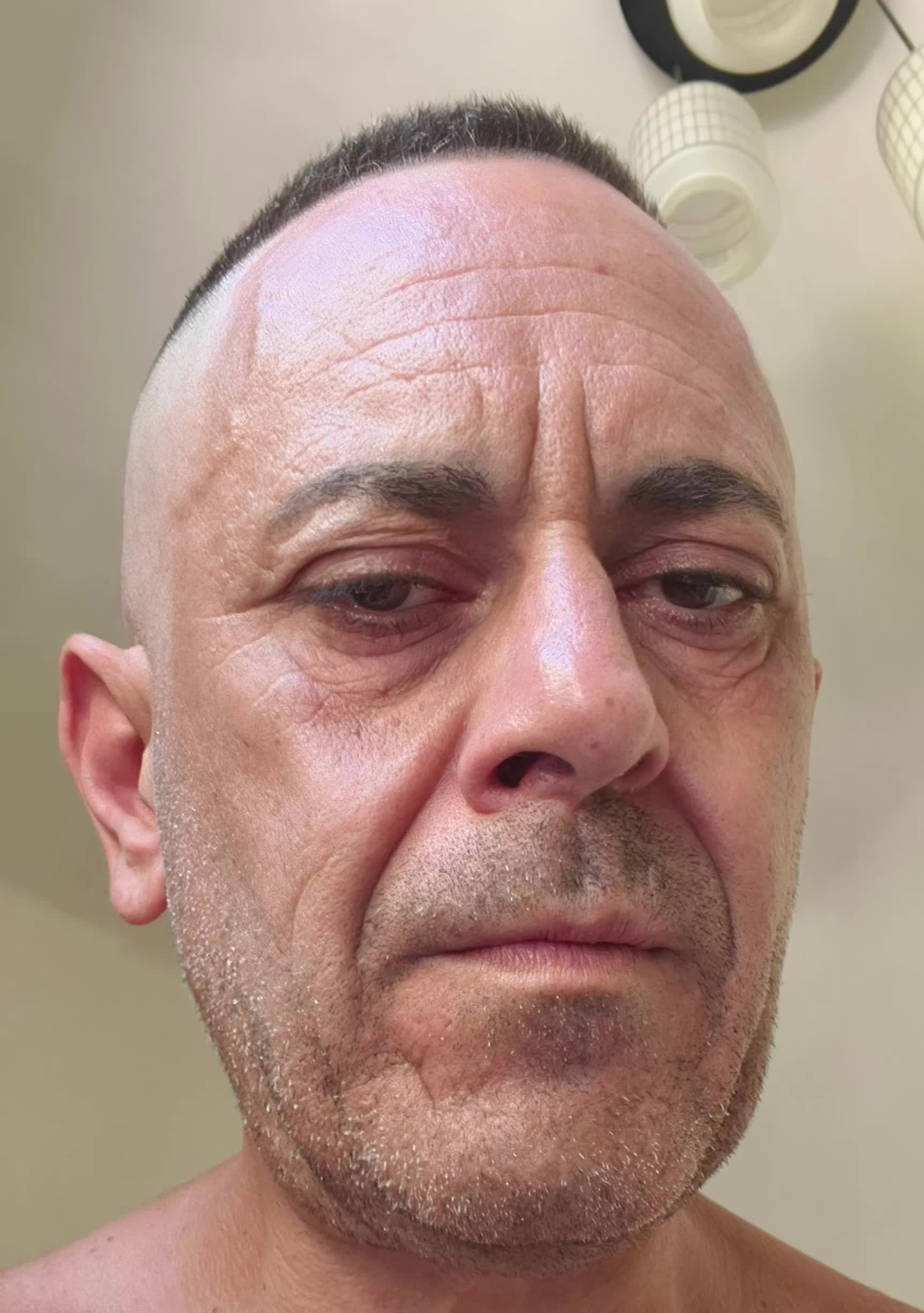 @Francesco Frascina