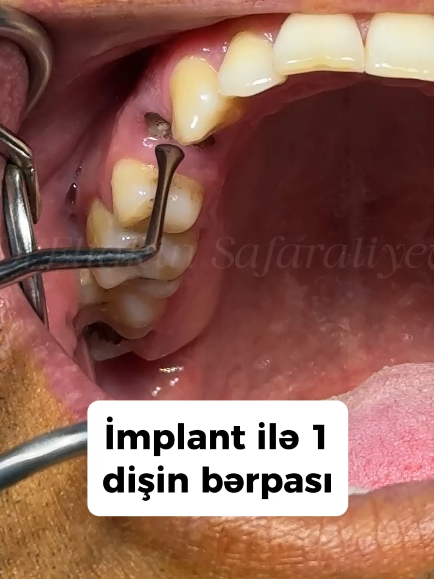 @eltakindentistry