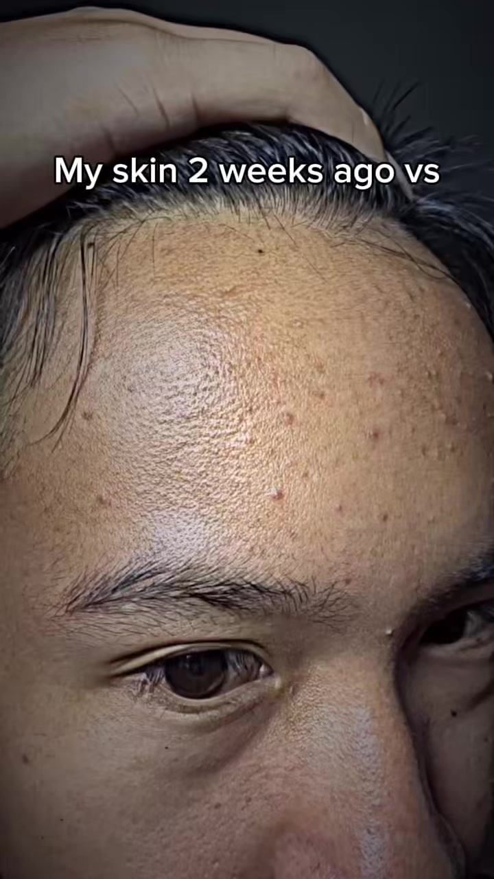 @IG : Chxrllss_