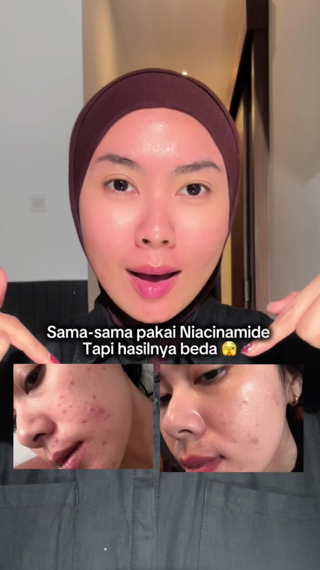 @Nonatyas