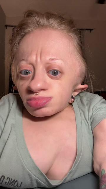 @Abby♿️