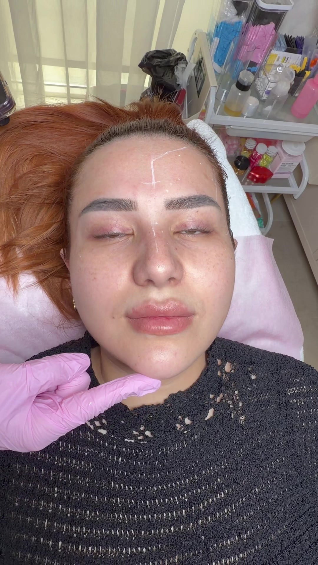 @cosmetolog.Ilaha🇹🇲🇦🇿