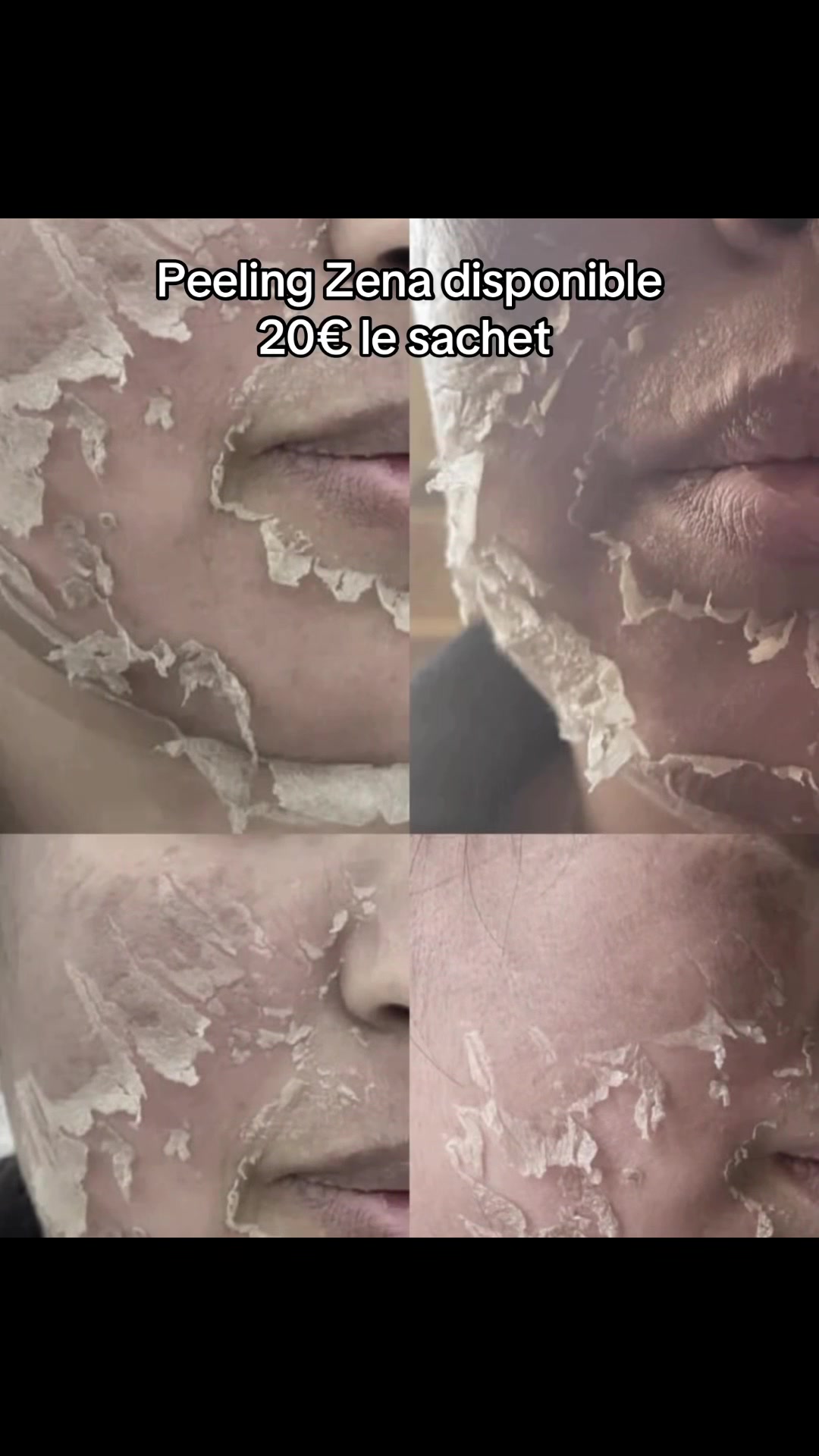 @peeling_zena