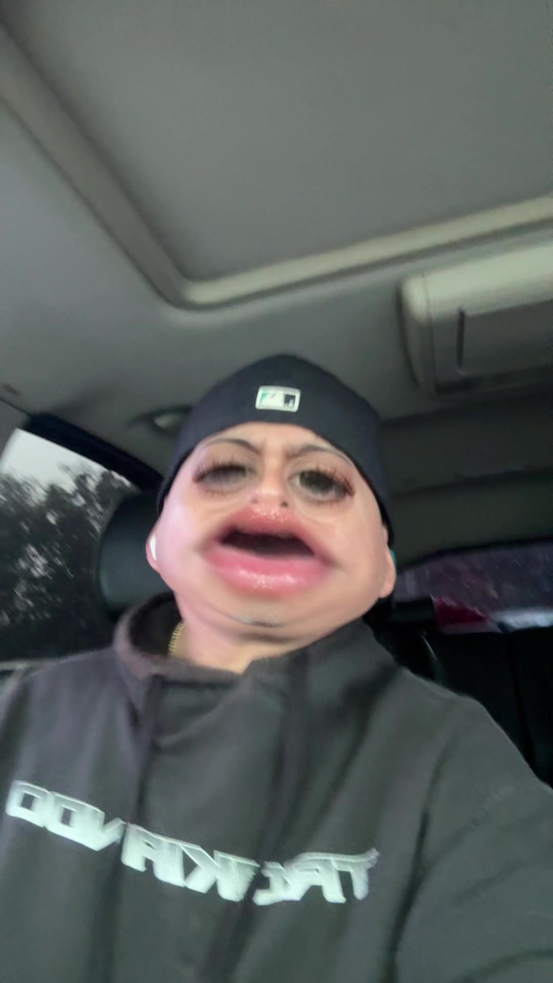 @MP