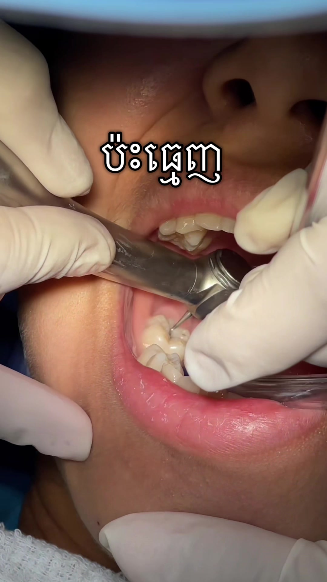 @BRIGHT SMILE DENTAL HOSPITAL