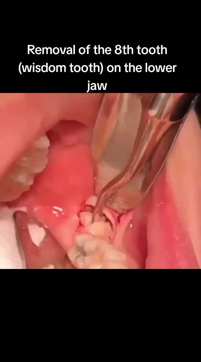 @Anatomy & Medicine