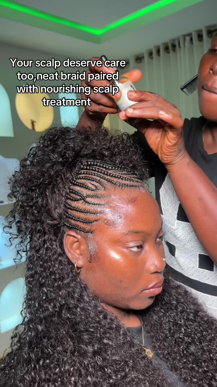 @Pemisire hairline