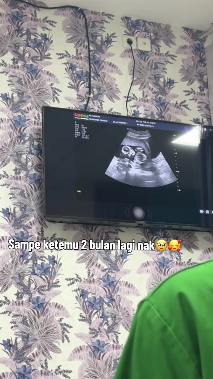 @Akunbaru
