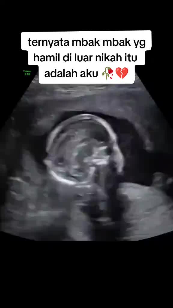 @ARISKA PUTRI