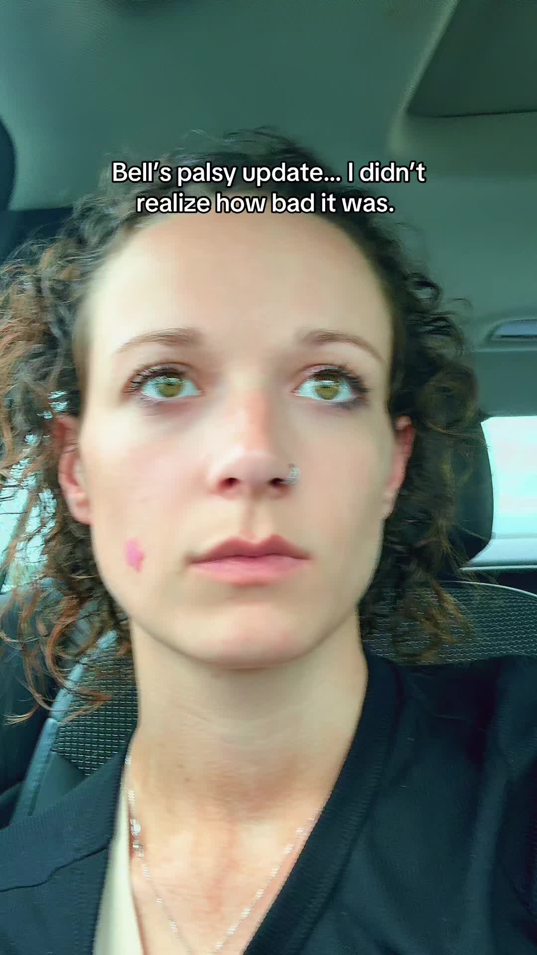 @SurvivingDv