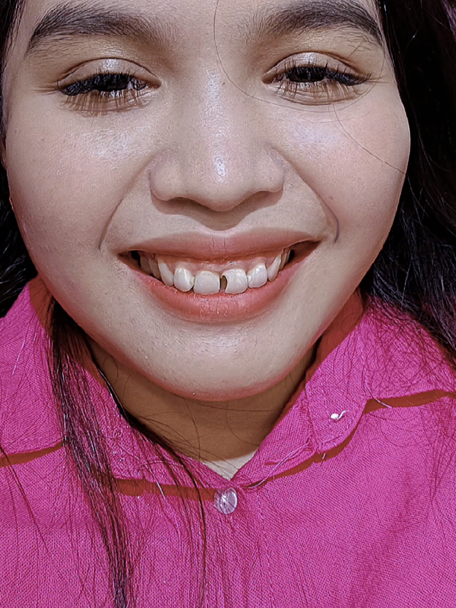 @Fiqygigi