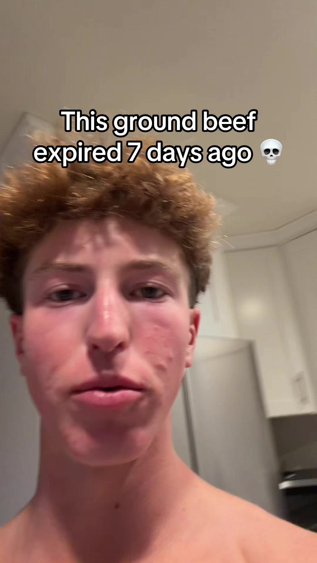 @BP