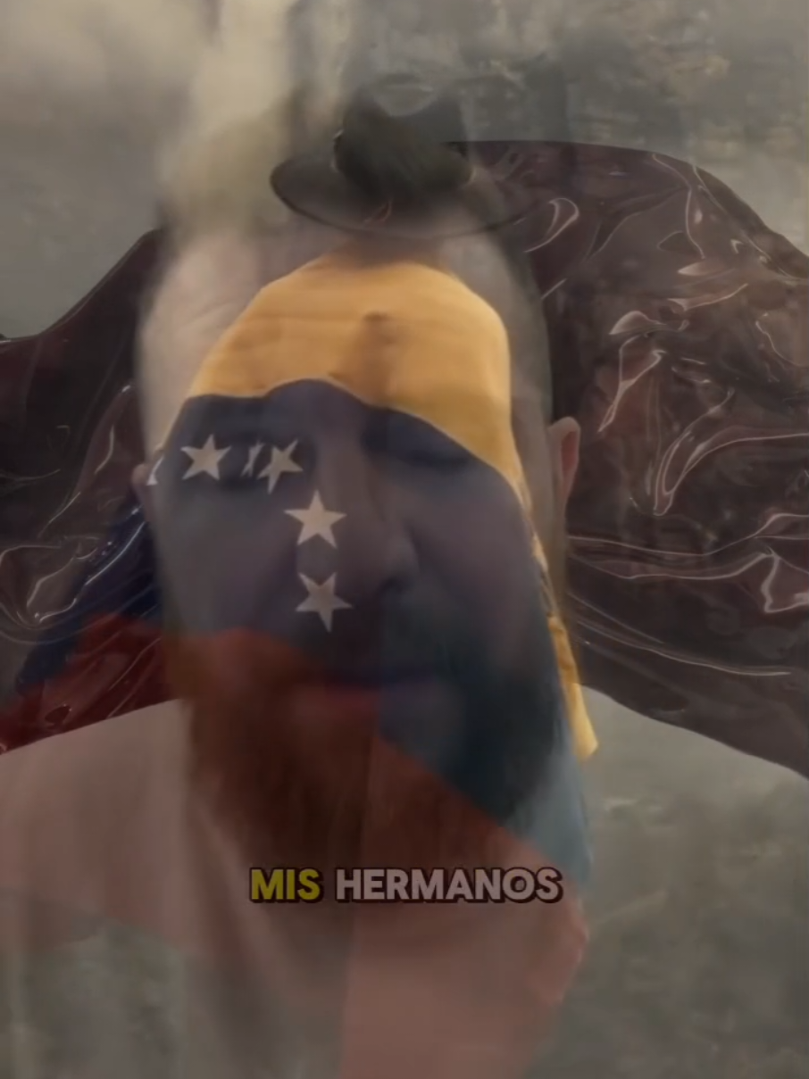 @🇻🇪🇲 🇮 🇨 🇭 🇦 🇪 🇱 🇻🇪