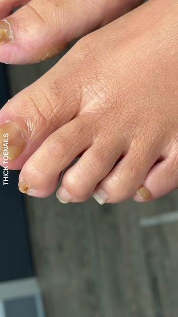 @Deniel Foot and Ankle Center