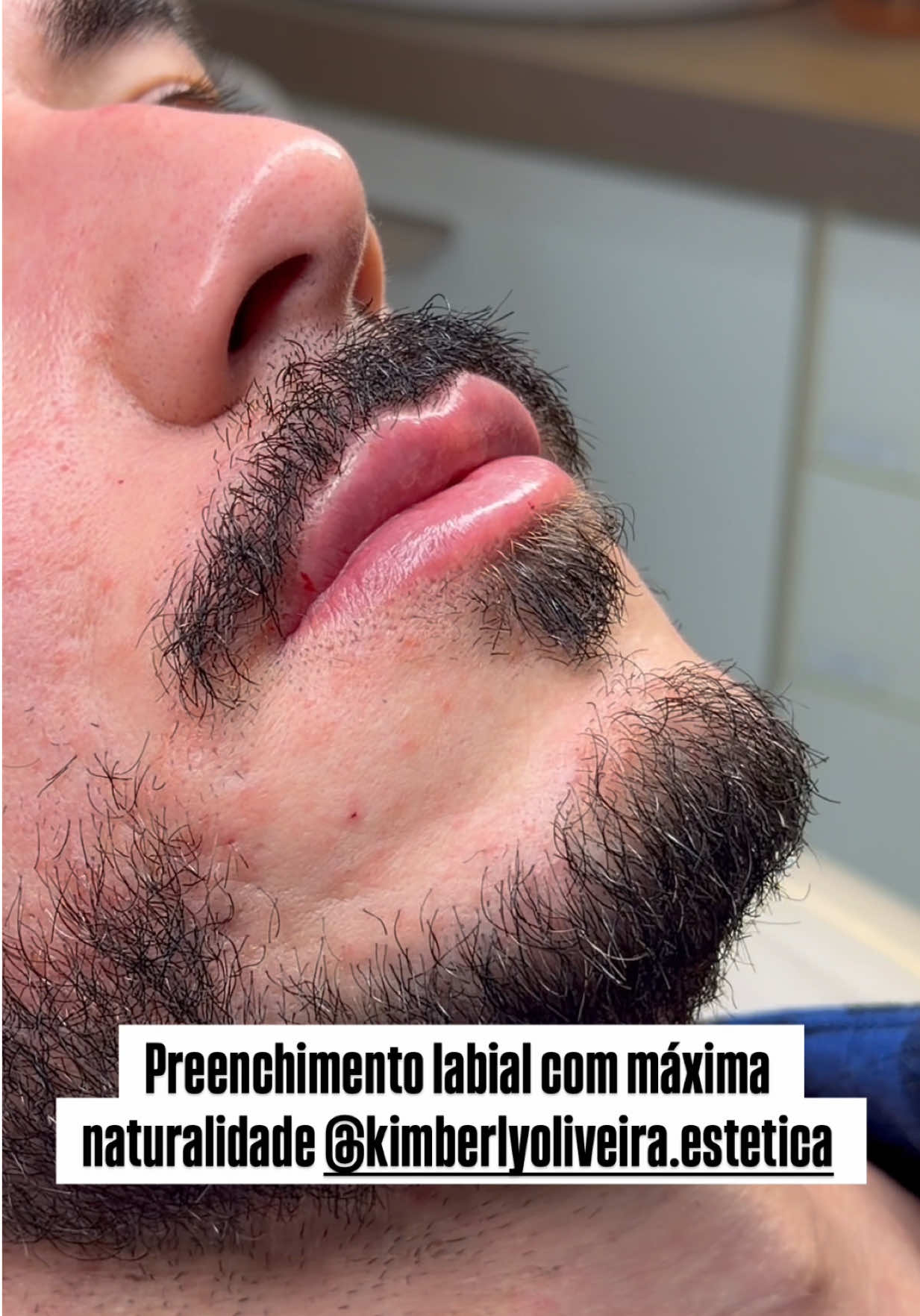 @Mateus Bandeira