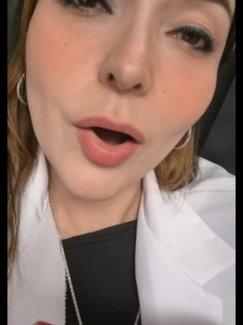 @AlExA