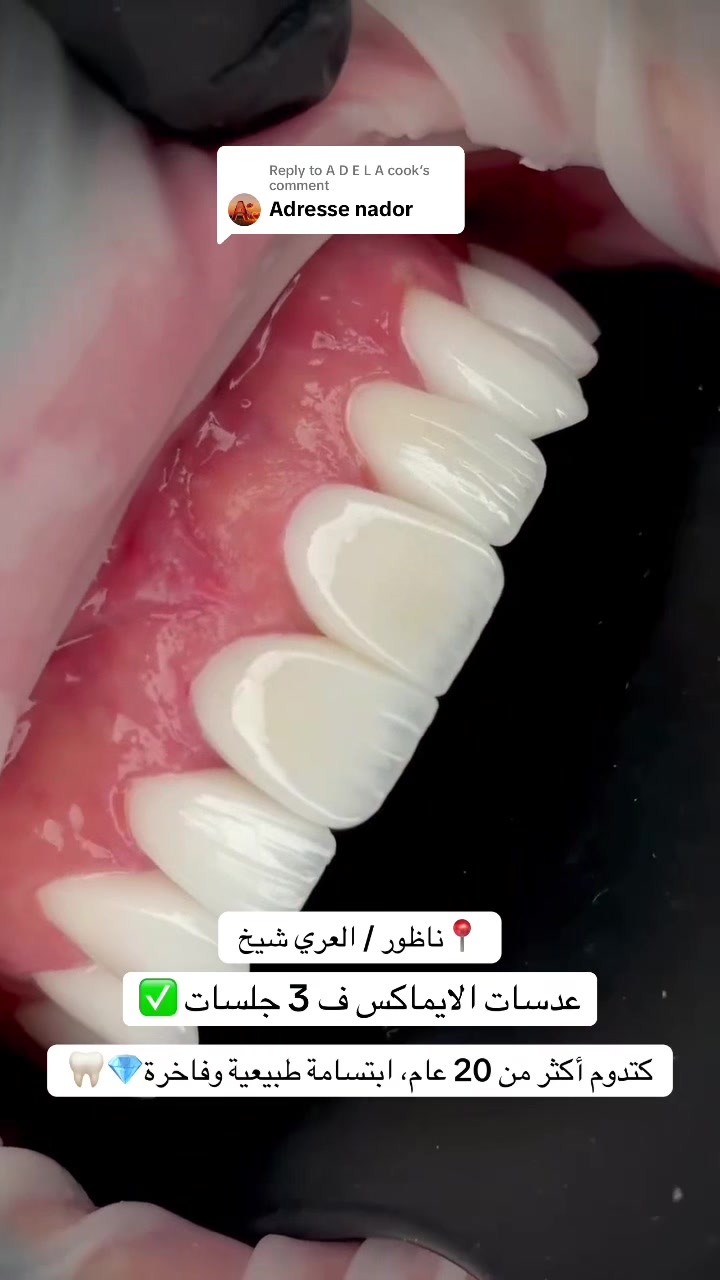 @brightsmileee1