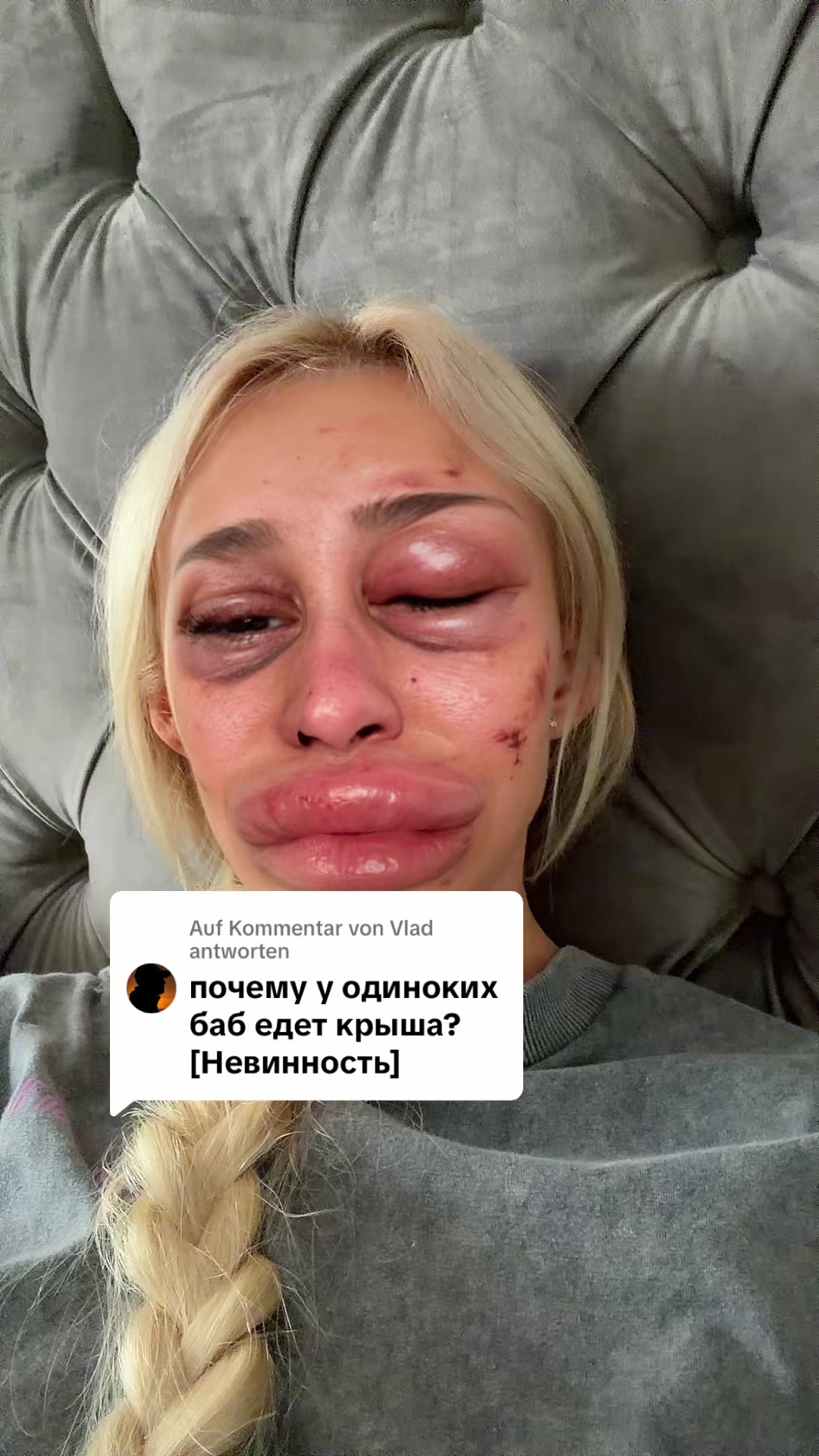@Solnze 23