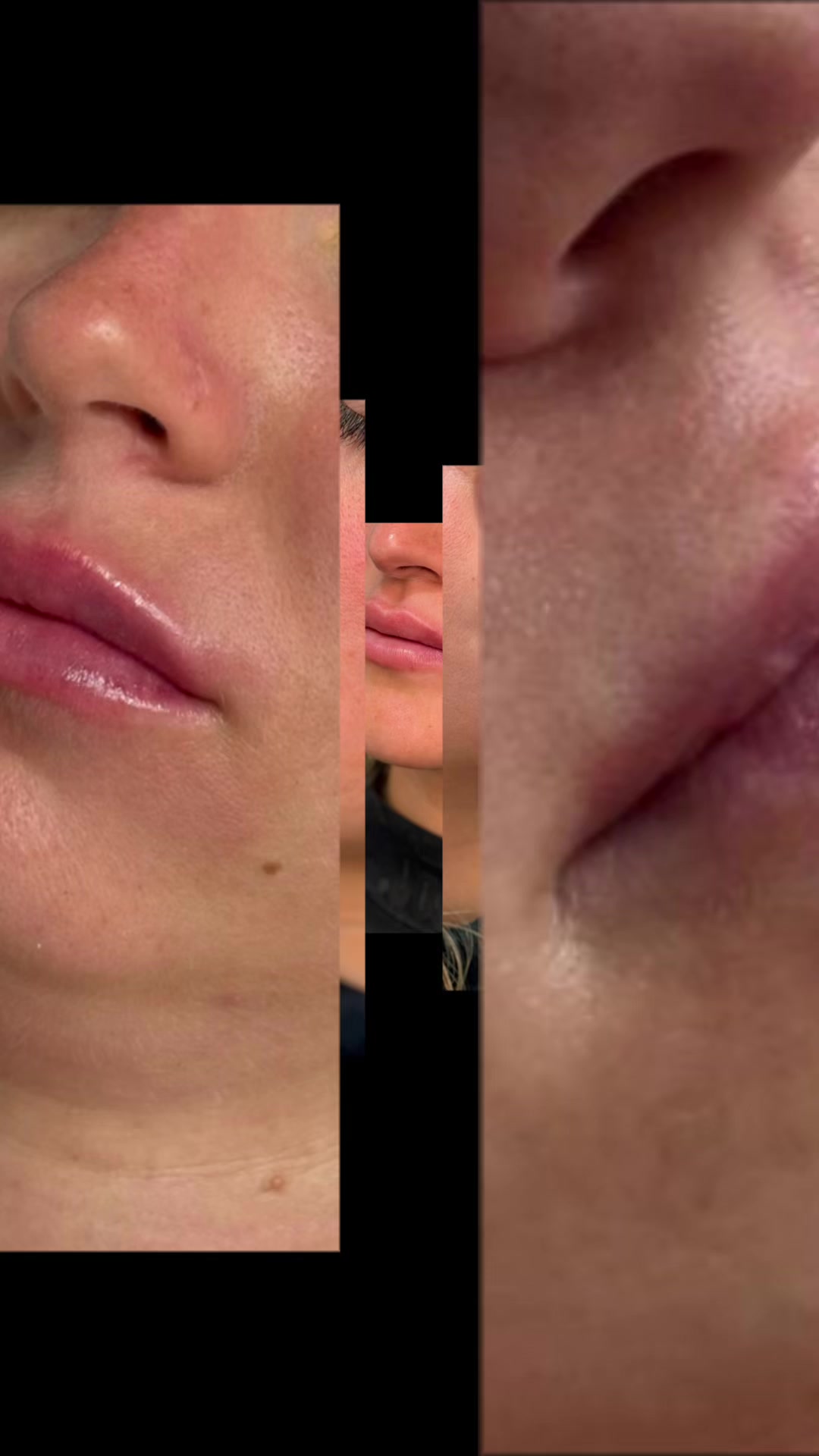 @DivaLaserCentar