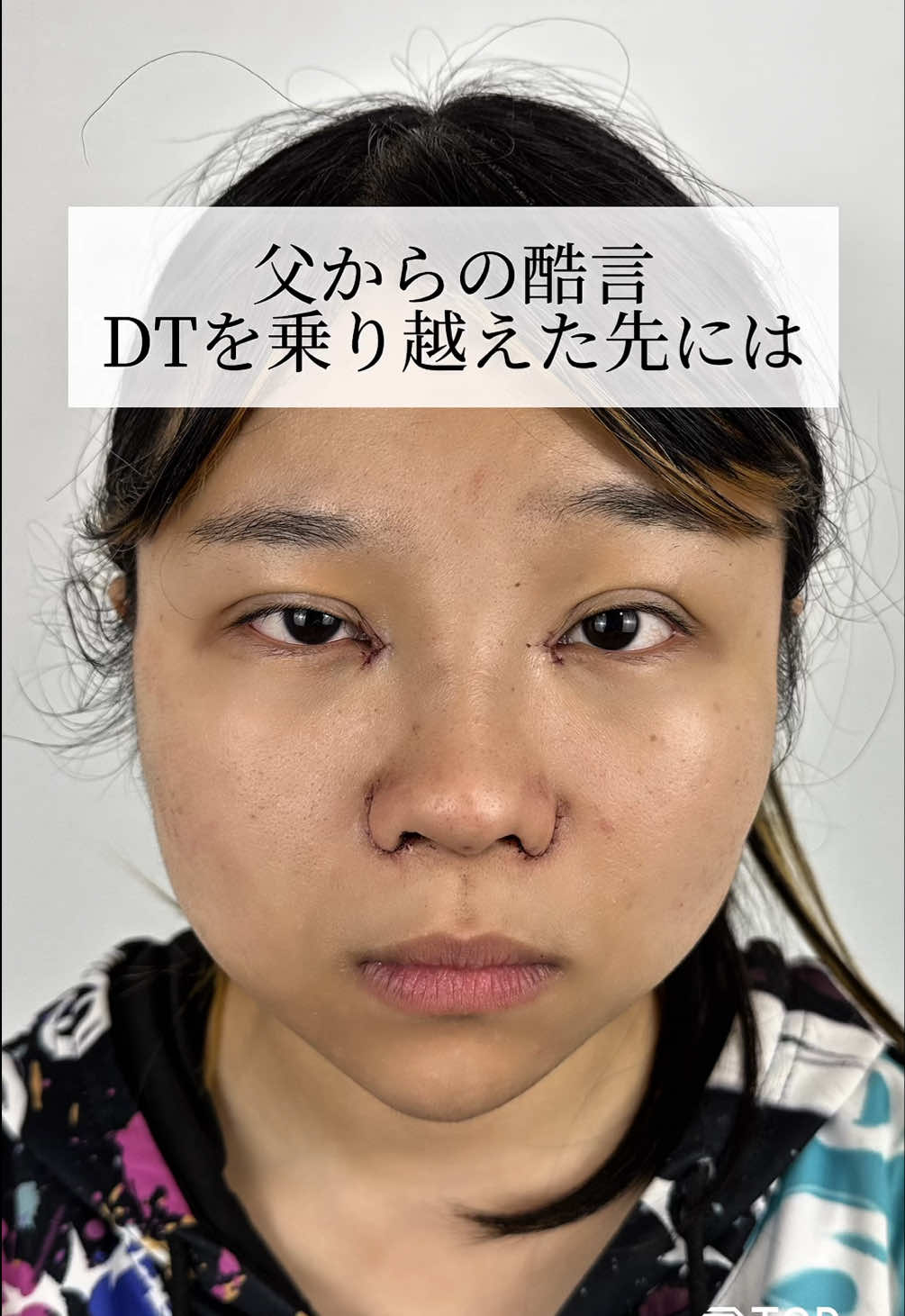 @【二重整形】TCB 新宿東口院ゆいこ先生/東京