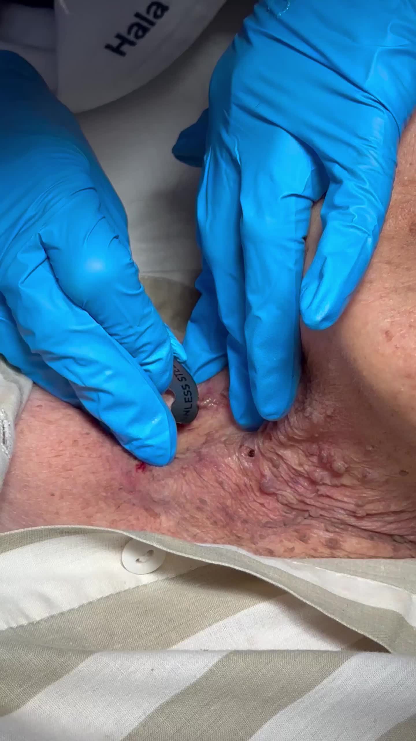 @Hala Koudsi M.D.