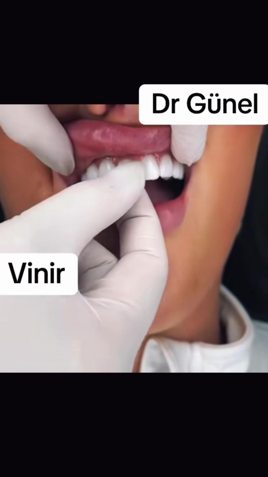 @Dentist_G&uuml;nel