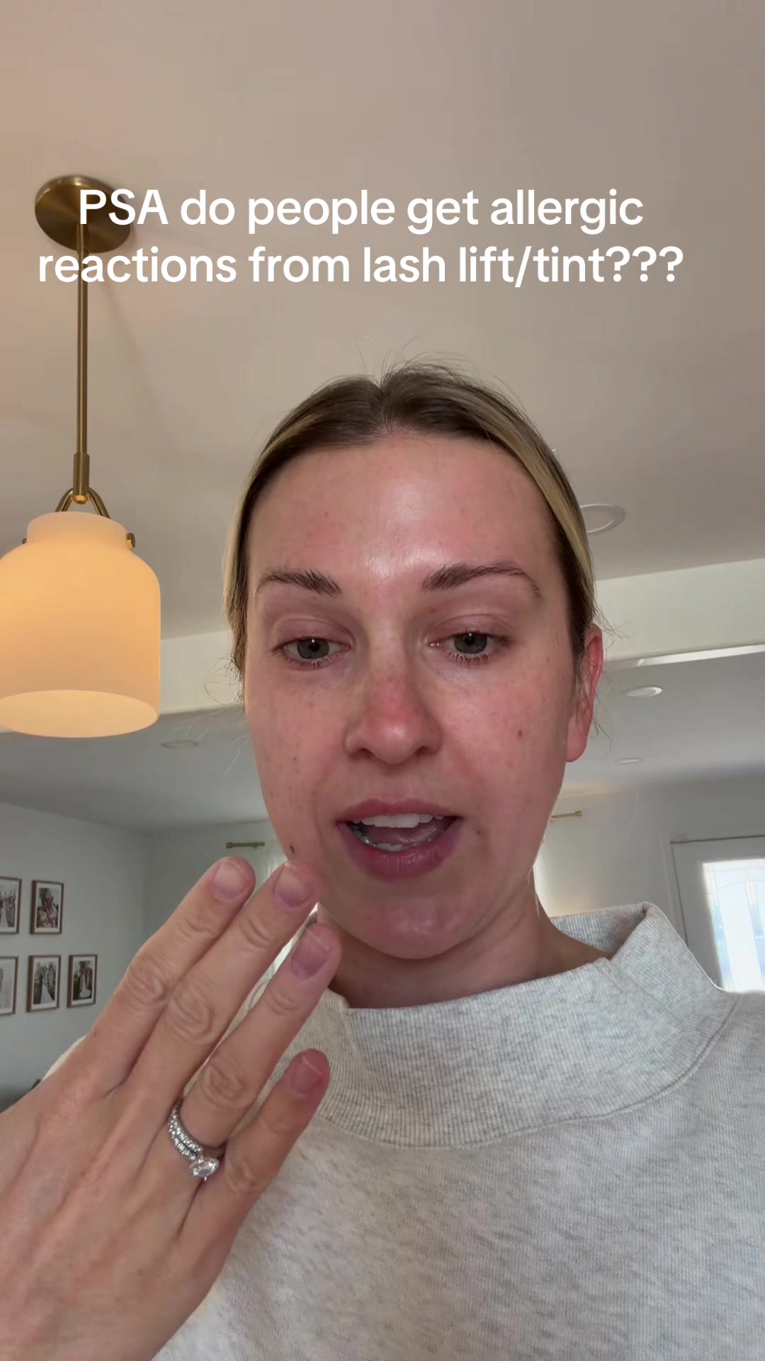 @allergygirl