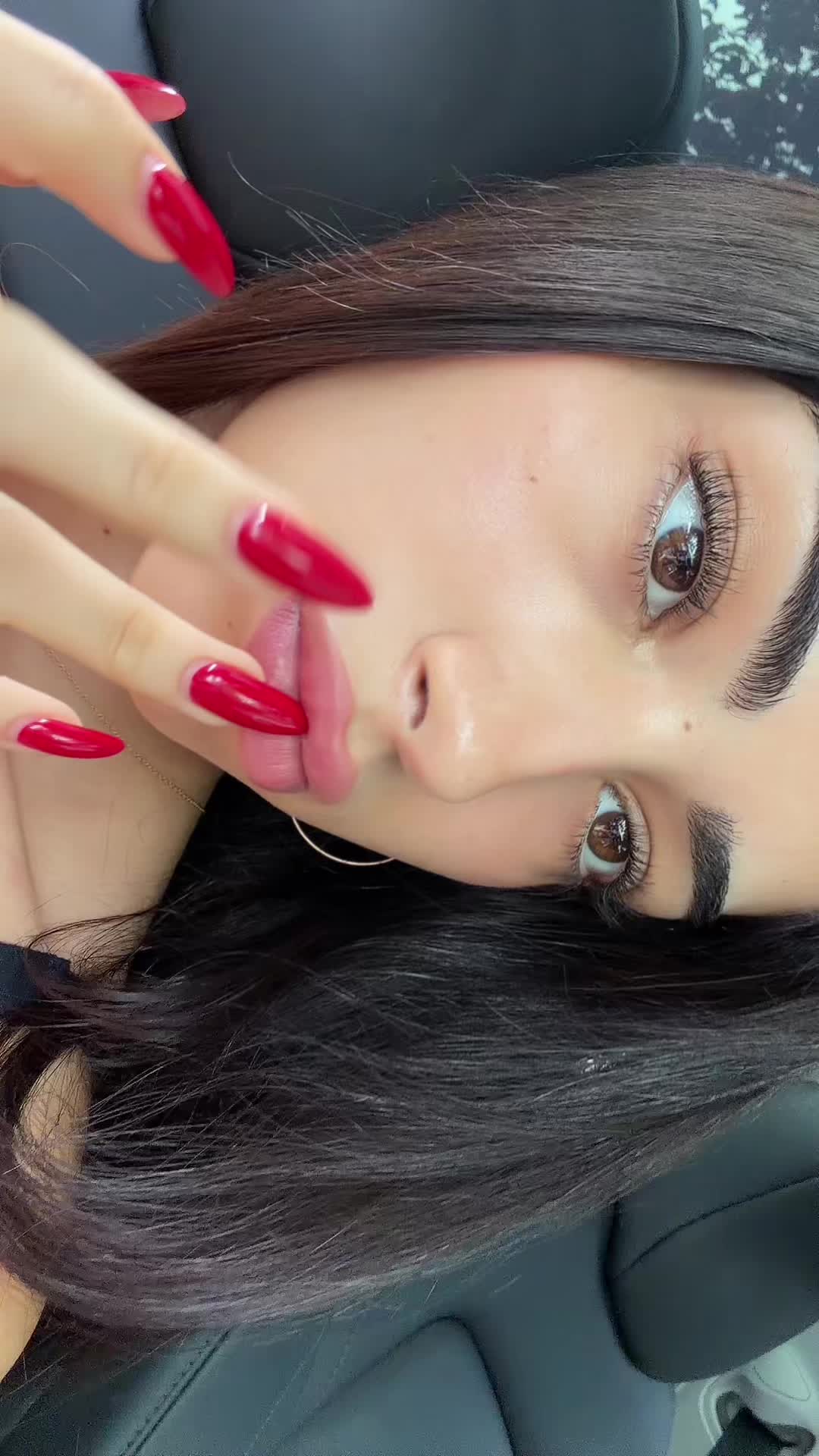 @ani