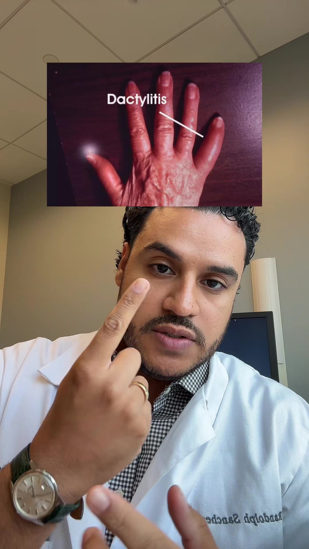 @Dr. Inflammation (MD, F.A.C.R)