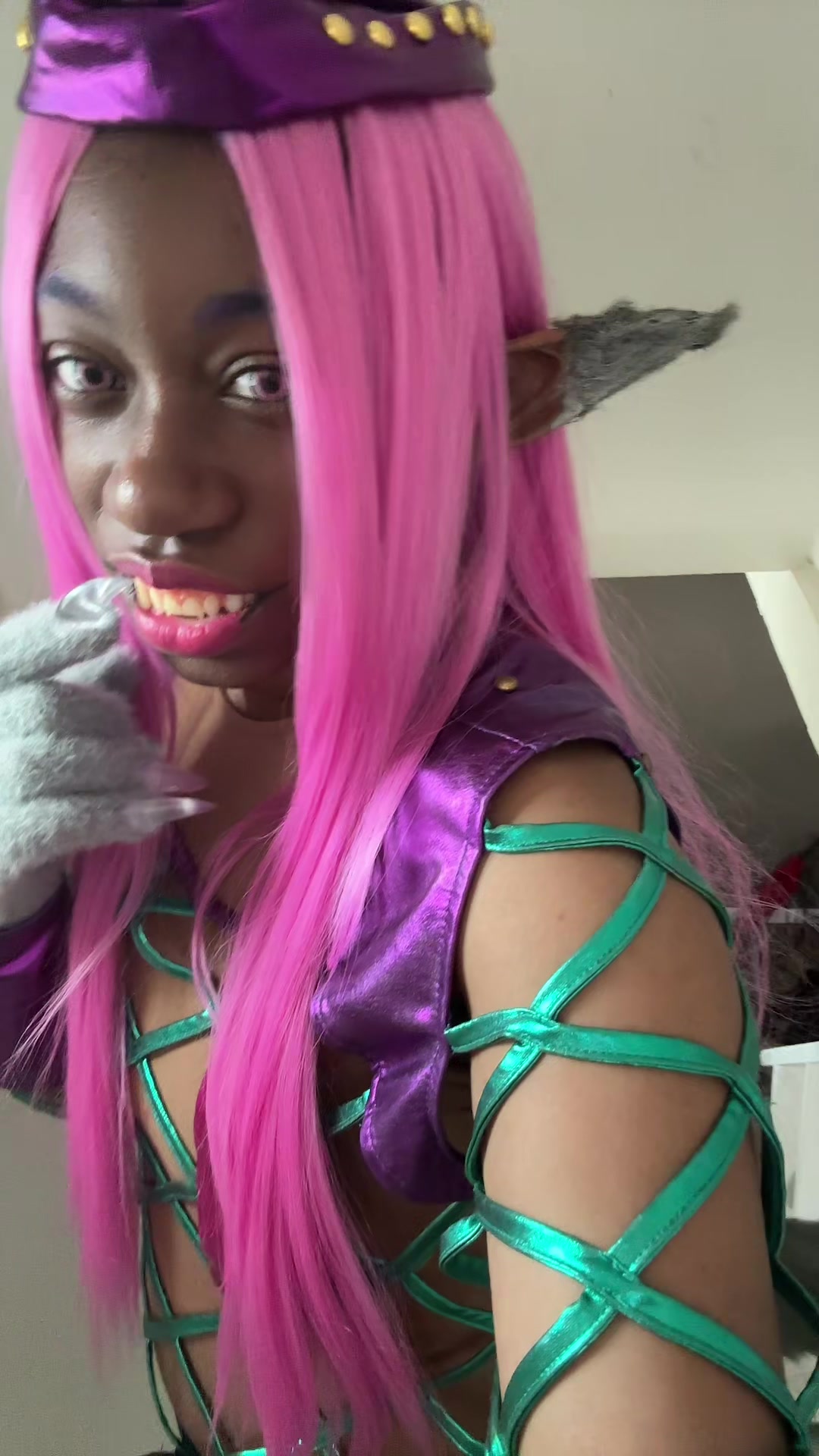 @Cheese (Anasui’s #1 fan)