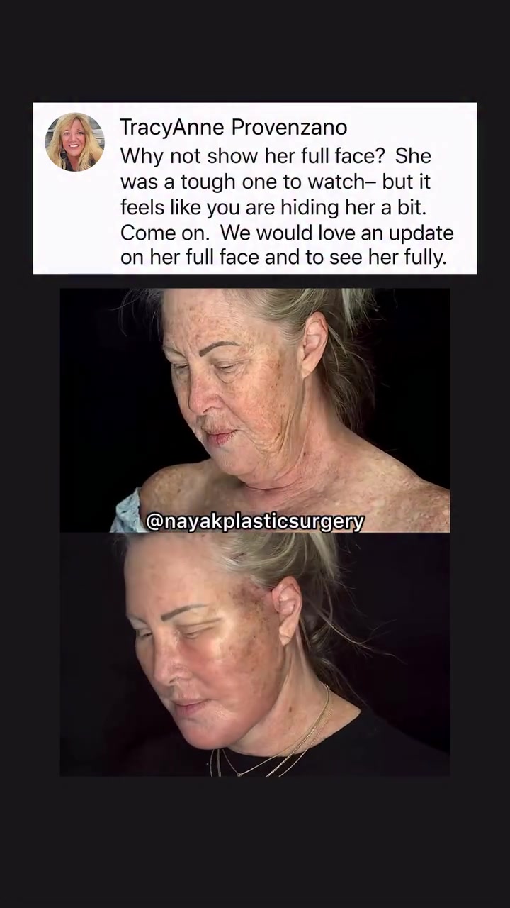 @NayakPlasticSurgery
