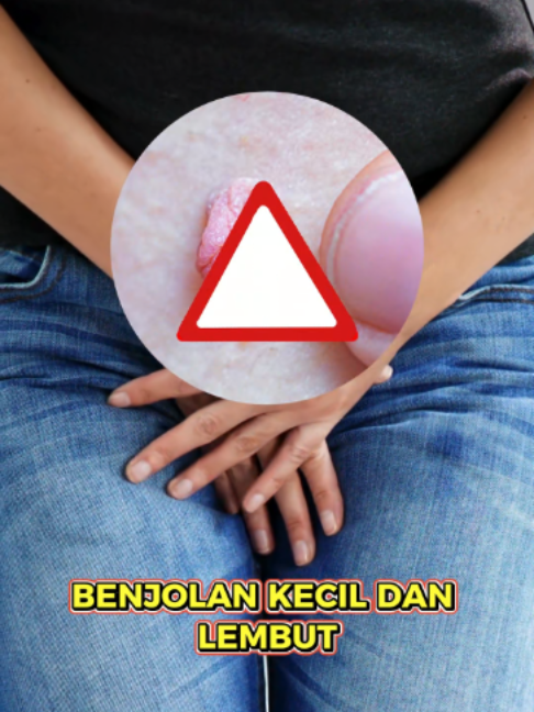 @KLINIK APOLLO JAKARTA