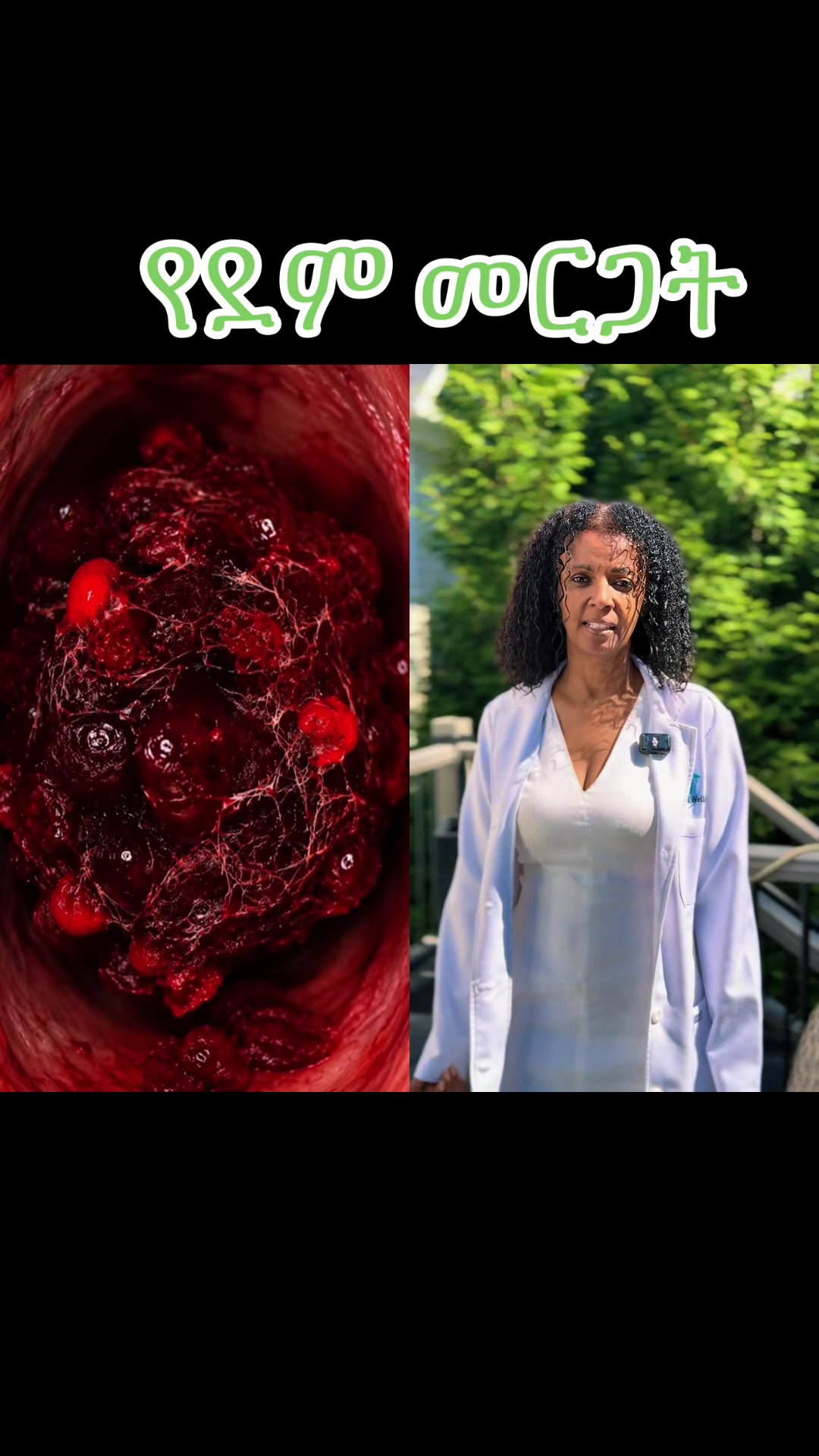 @Nebix (ፍቅር )❤️L