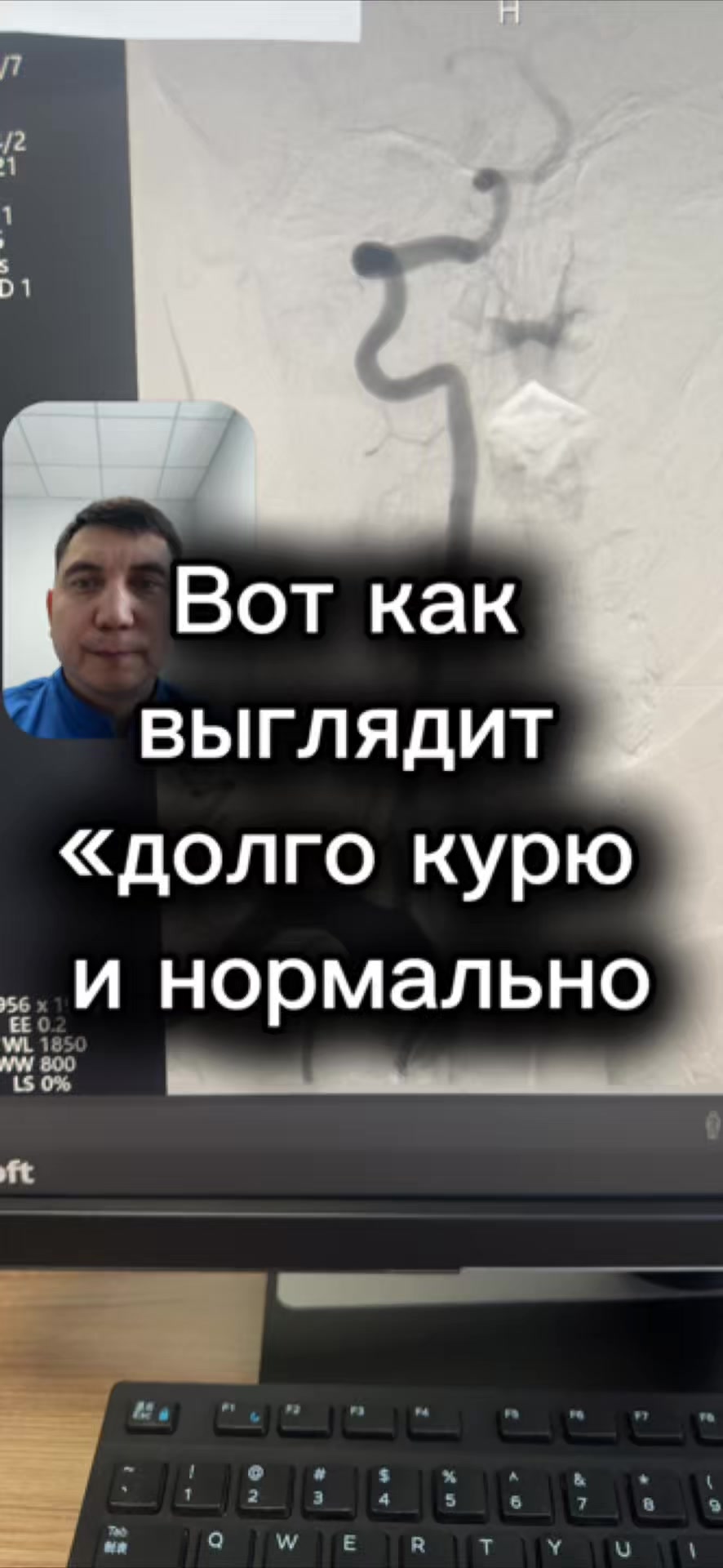 @Кардиолог / Аспет